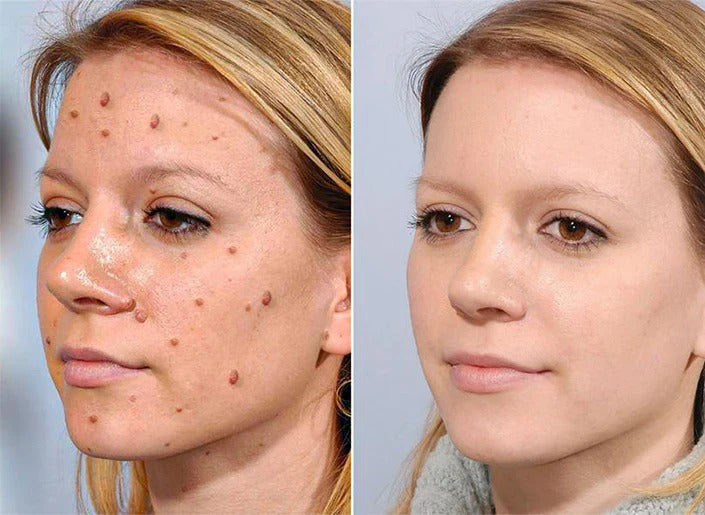 TagRecede Bee Venom Treatment Spray